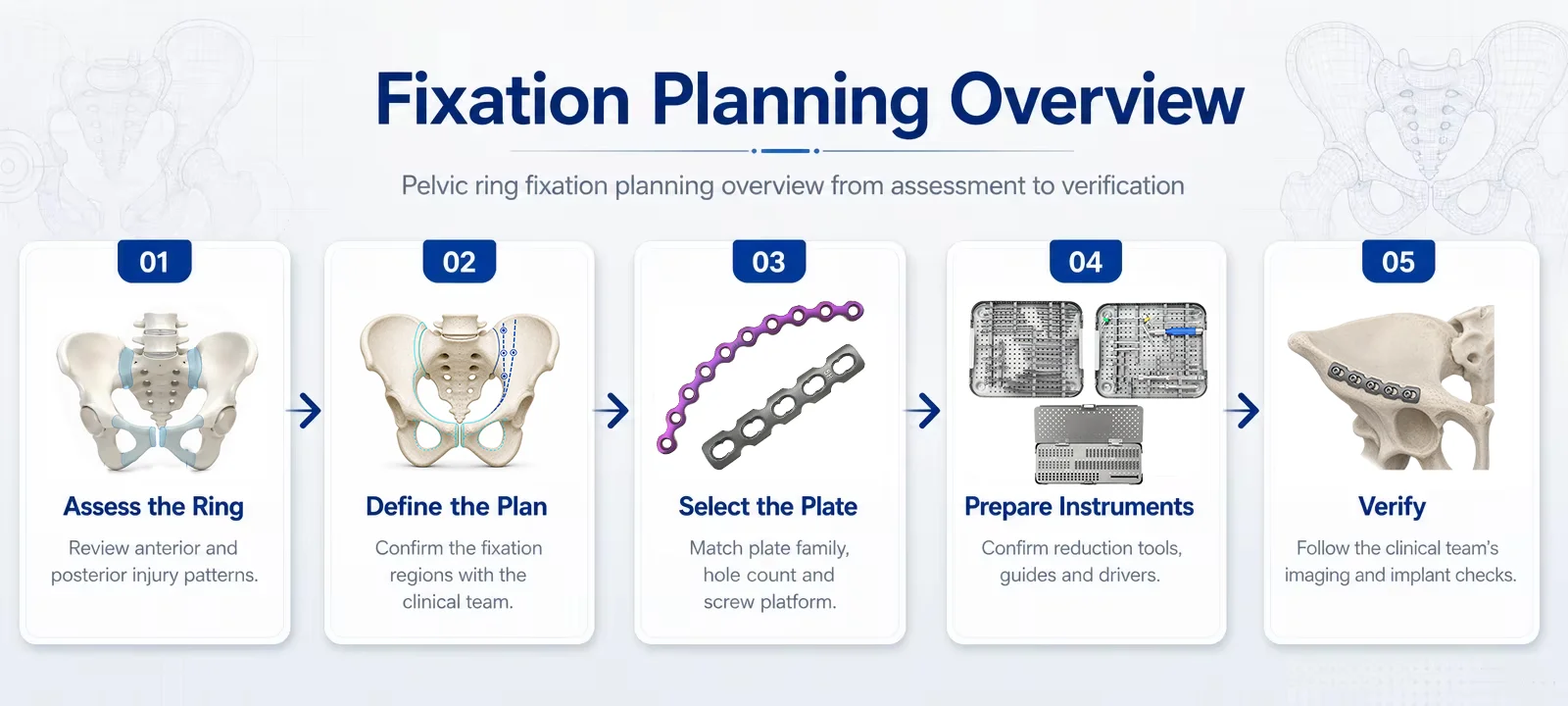Pelvic ring fixation planning overview from assessment to verification
