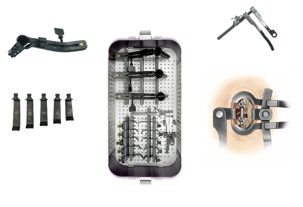 Detalles del retractor articulado MLD, esp&eacute;culo y hojas mediales para cirug&iacute;a lumbar 