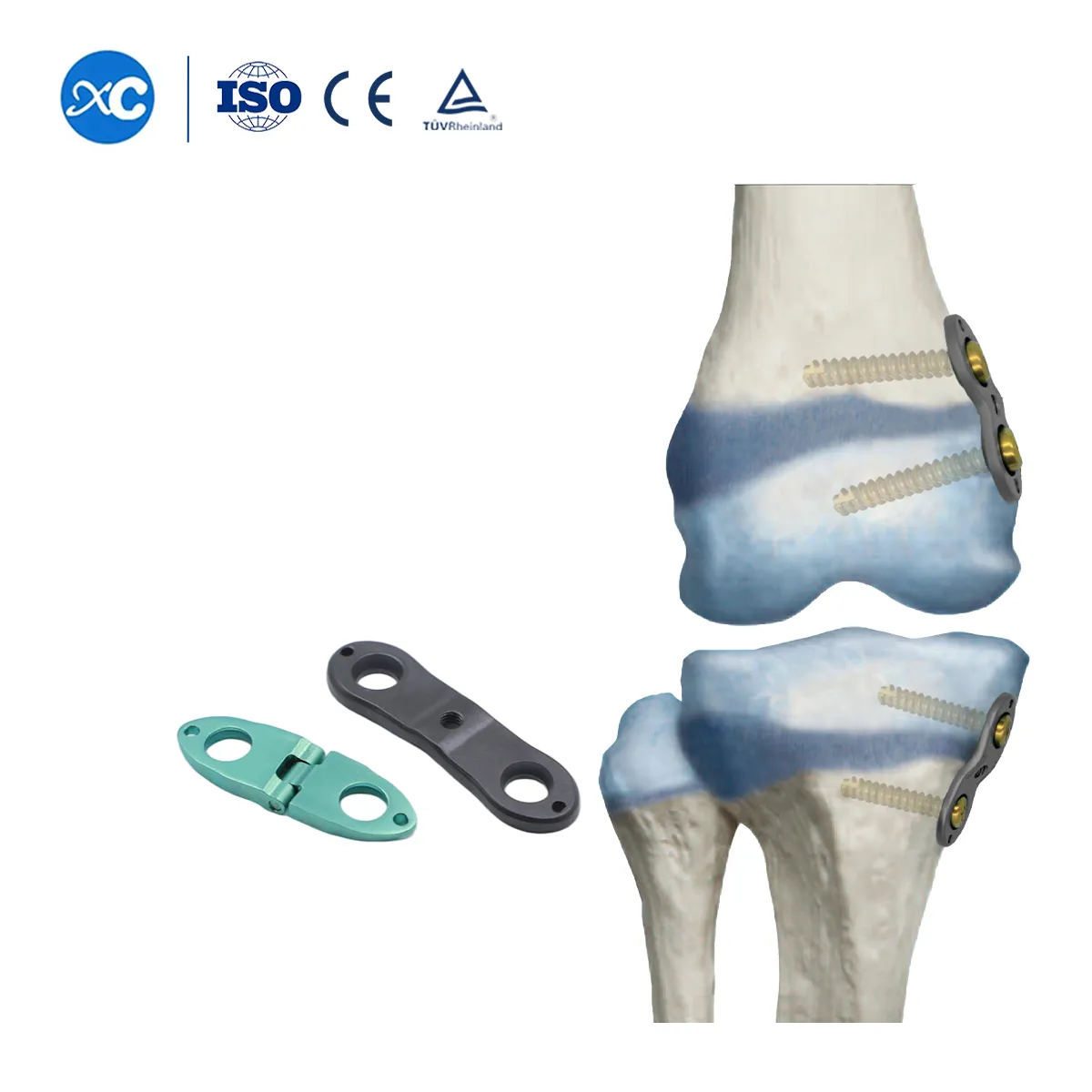 Sistema ortopédico pediátrico Valgus Varus