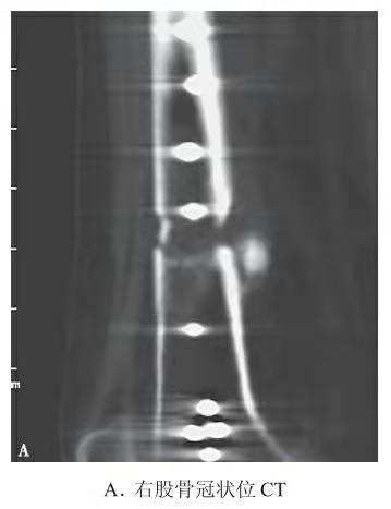 Radiograf&iacute;a representativa de una fractura femoral con fijaci&oacute;n con placa y formaci&oacute;n parcial de callo.