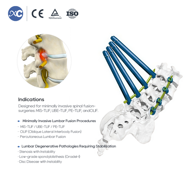 5.5 Instrumental MIS Spinal System II