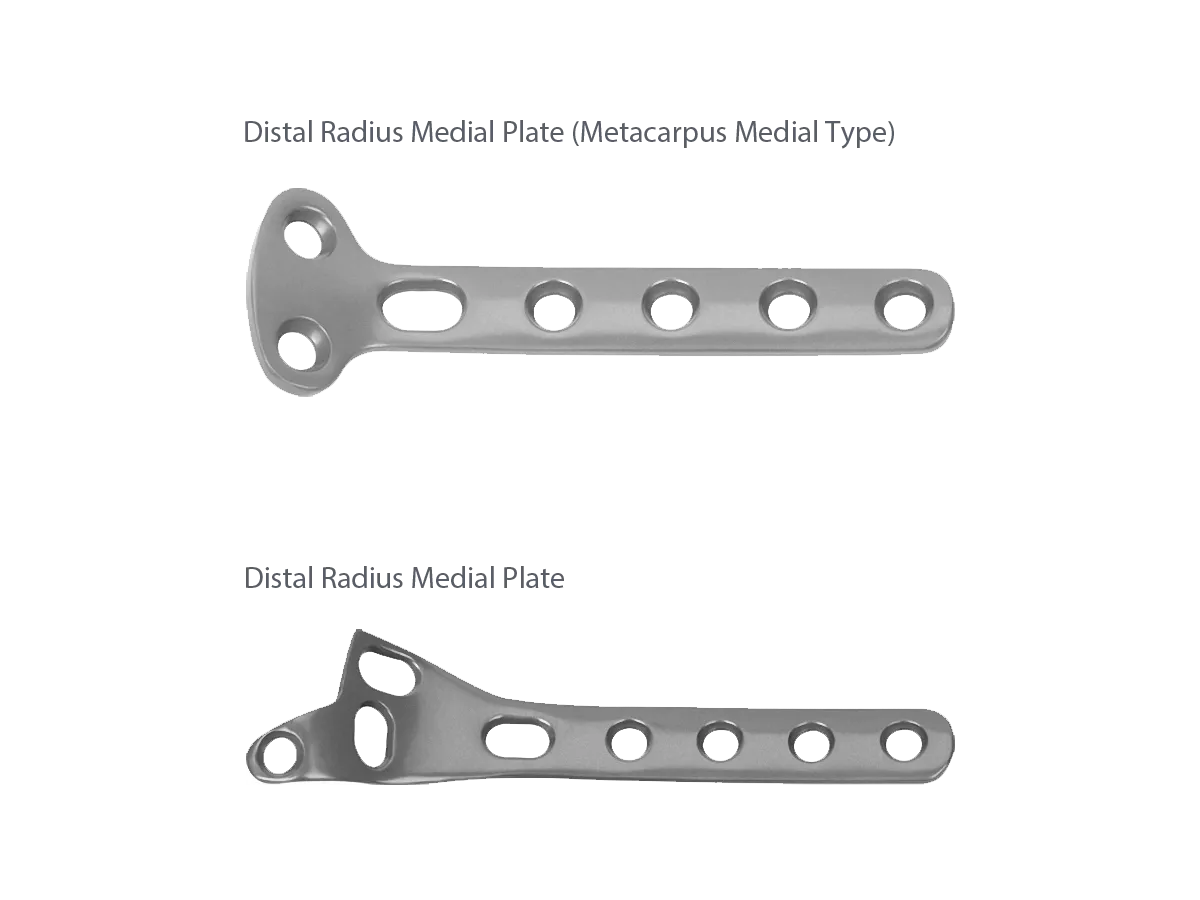 Non-locking distal radius medial plate options