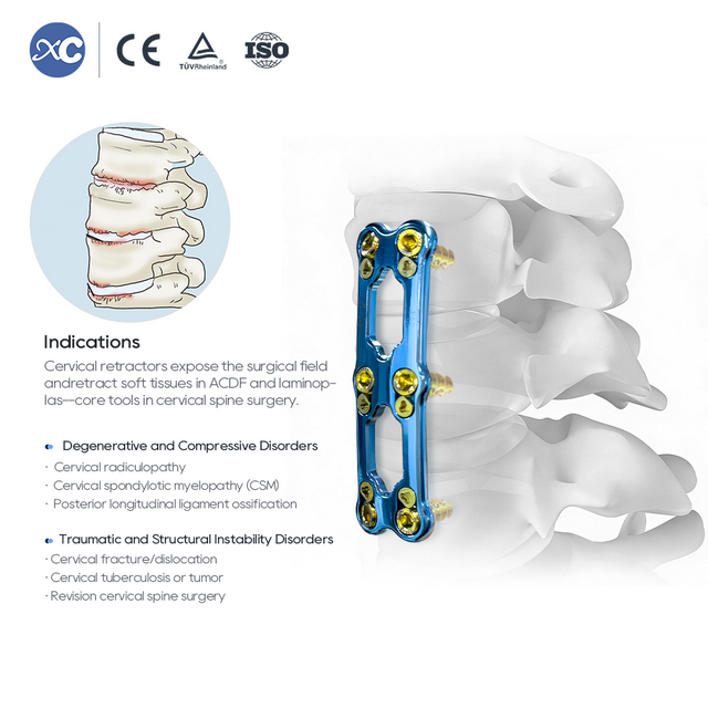 Juego de instrumentos para retractor cervical