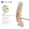 Conjunto de instrumentos para cirugía de columna UBE