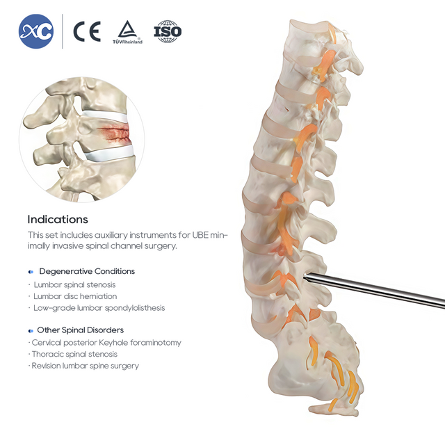 Conjunto de instrumentos para cirugía de columna UBE