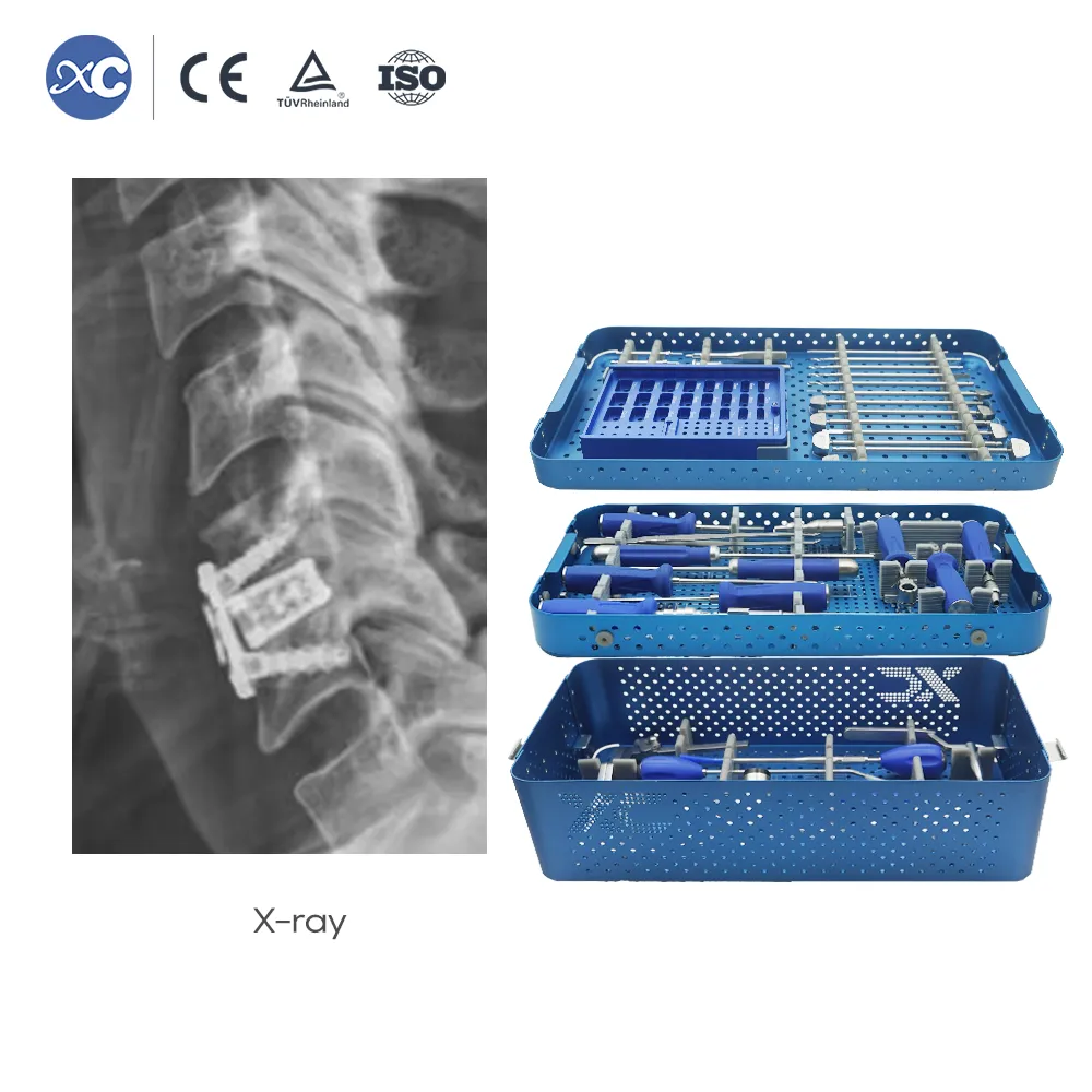Caja cervical de PEEK de perfil cero con juego de instrumentos exclusivo con 4 tornillos de bloqueo