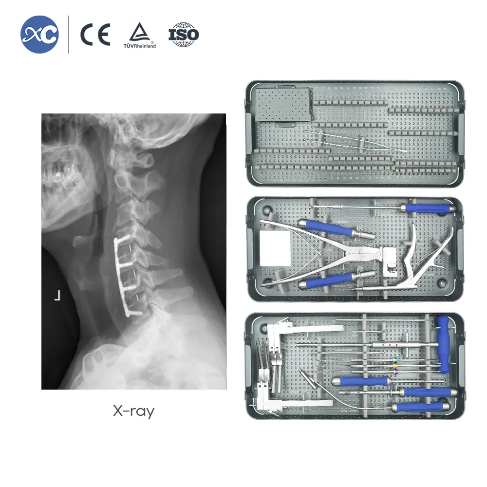 Juego de instrumentos para placa cervical anterior ultrafina de 0,8 mm