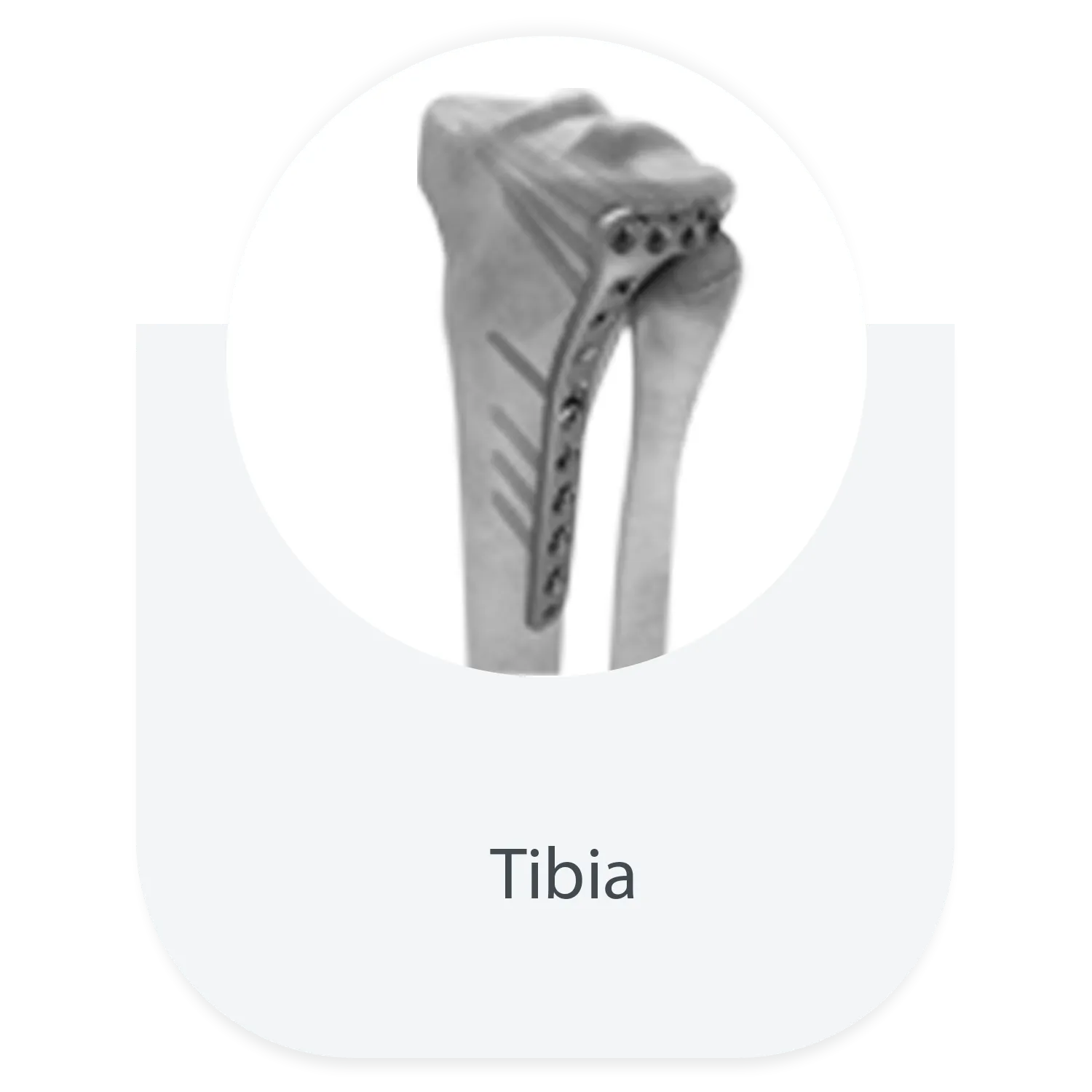de bloqueo de la tibia Placa 