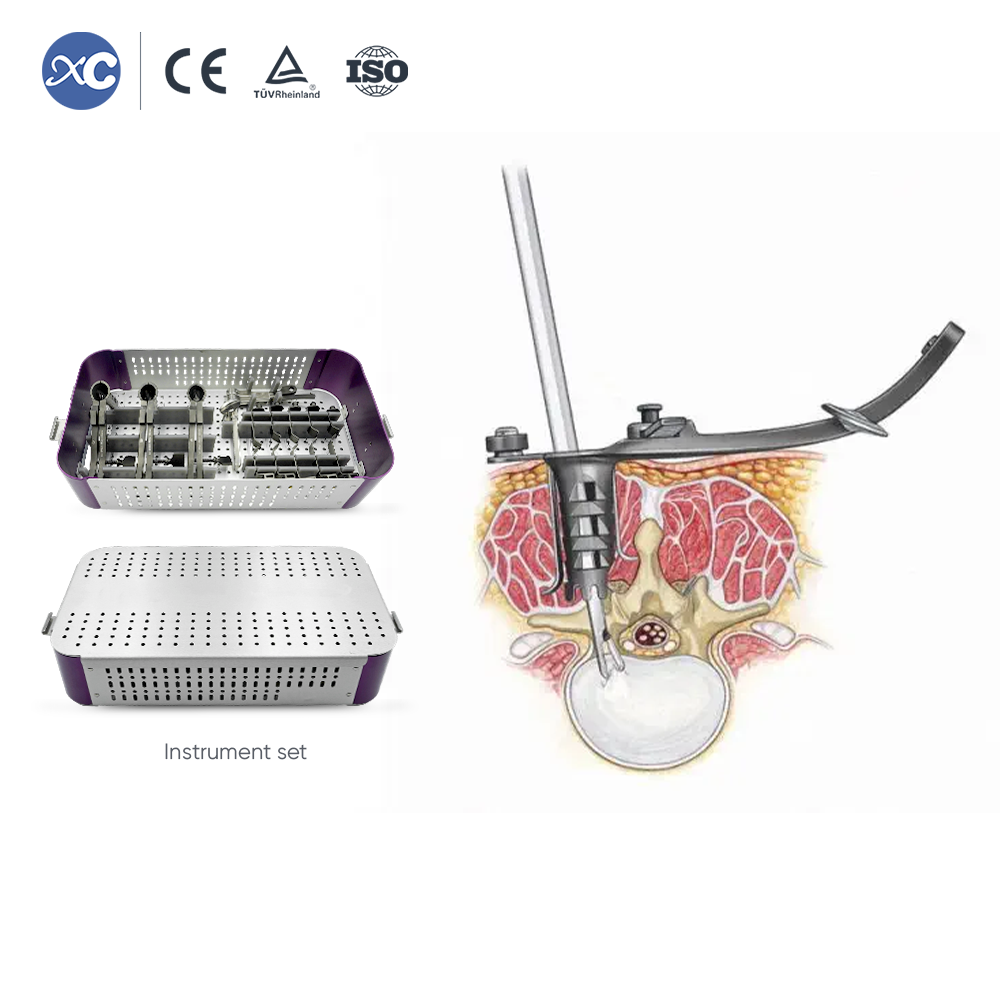 Juego de instrumentos retractores articulados MLD
