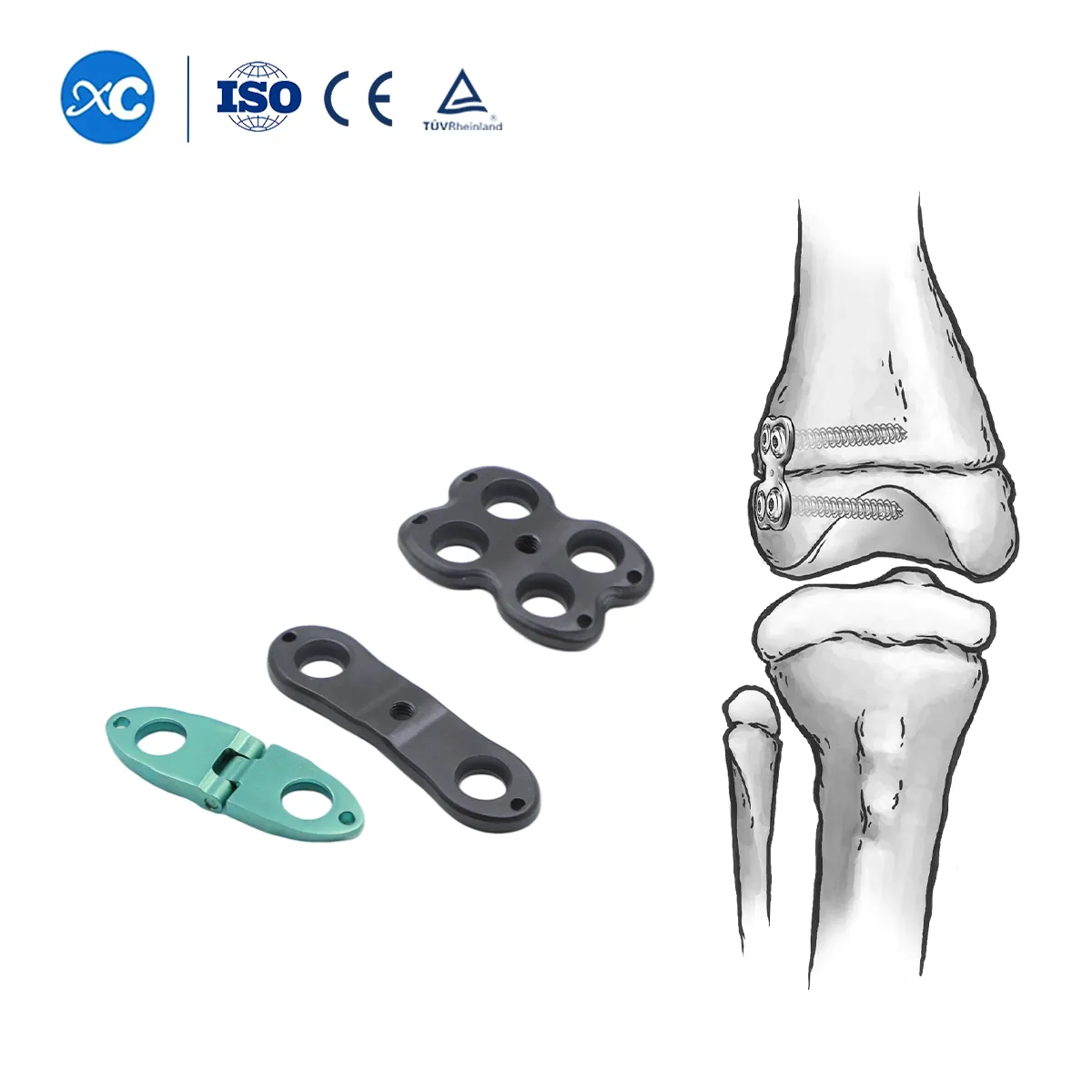 Sistema ortopédico pediátrico Valgus Varus