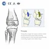 Conjunto de instrumentos ortopédicos pediátricos Valgus Varus