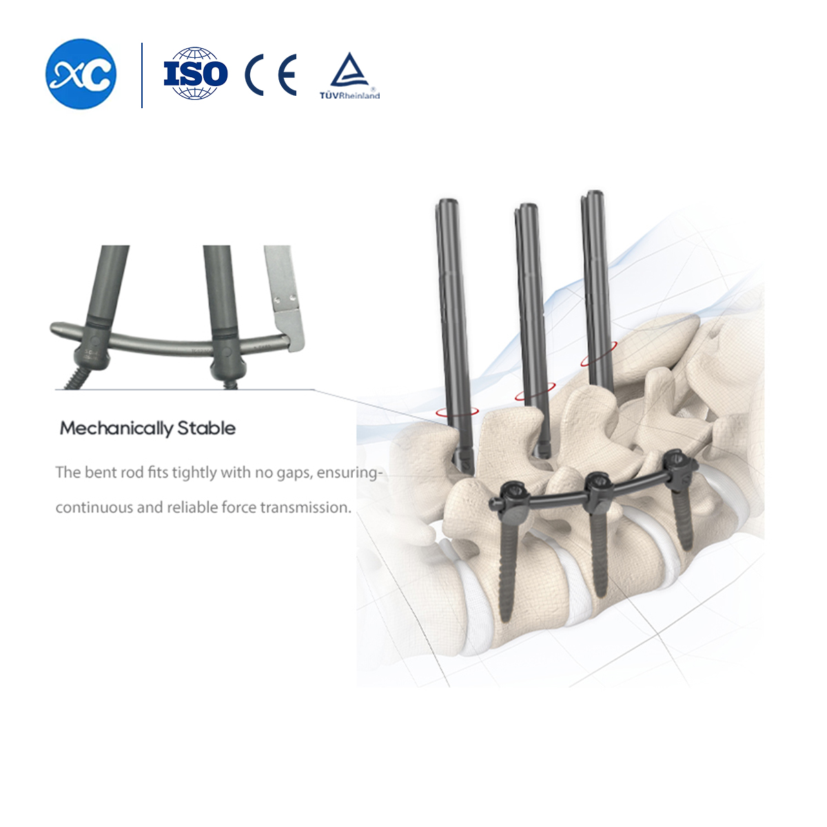 5.5 Tornillo pedicular Il para sistema espinal MIS