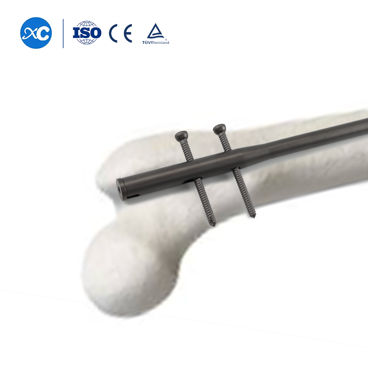 Sistema de clavo intramedular femoral