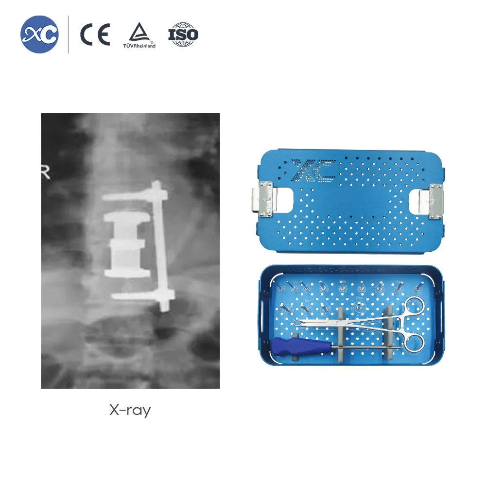 Conjunto de instrumentos de jaula de fusión ajustable para jaula de titanio expandible