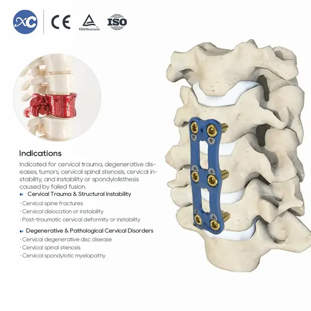 Sistema de placa cervical anterior ultrafina de 0,8 mm