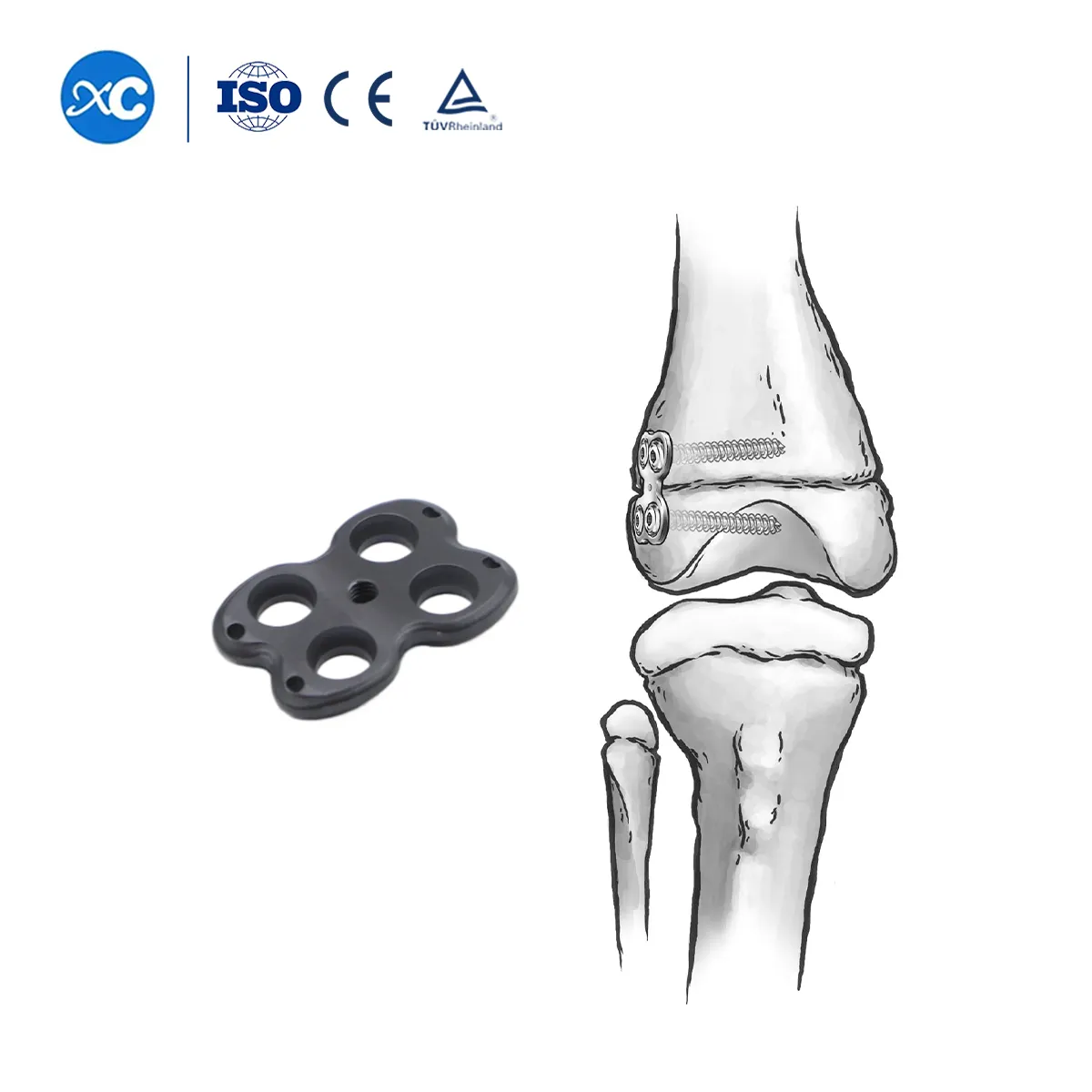 Sistema ortopédico pediátrico Valgus Varus