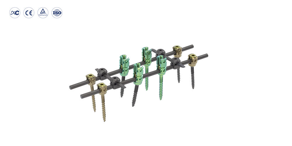Implantes toracolumbares con sistema de tornillo pedicular espinal de 5,5 mm