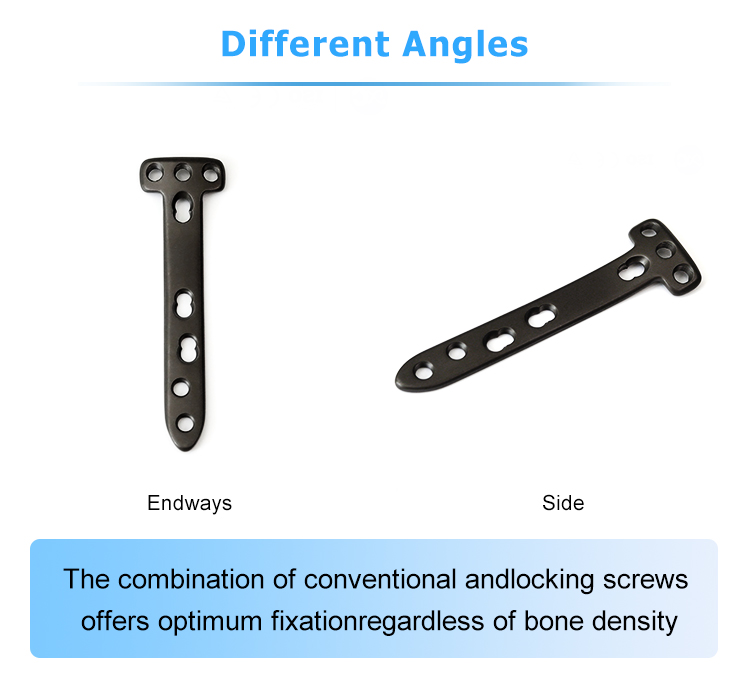 Placa-de-osteotom&iacute;a-tibial-proximal_03 