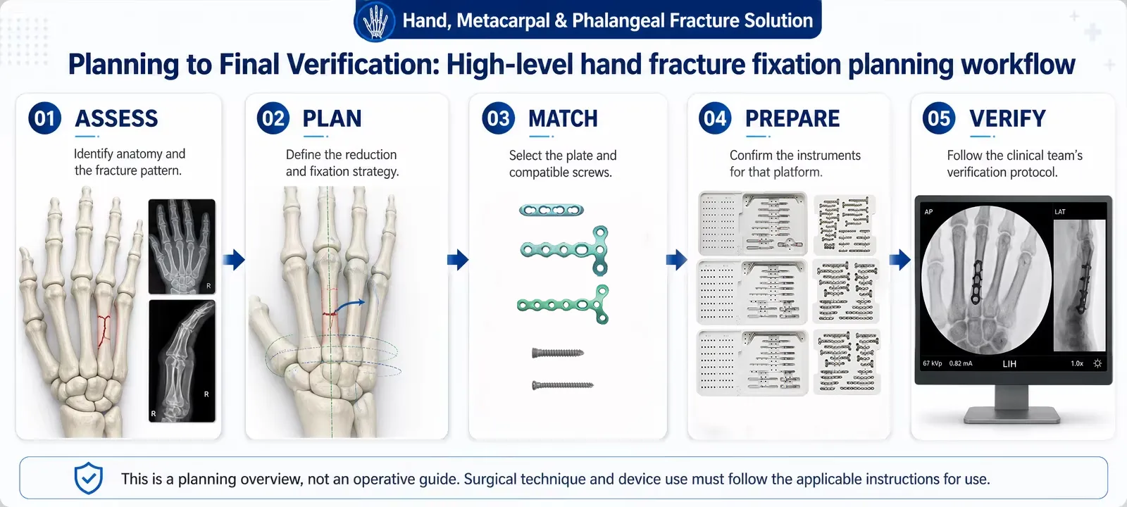 High-level hand fracture fixation planning workflow