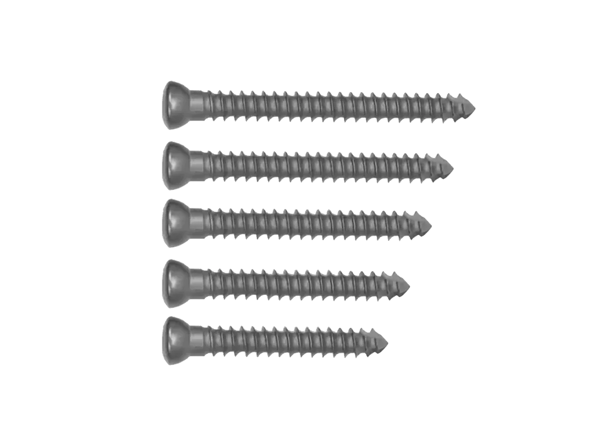 4.0 mm full-threaded cancellous screws for configuration review