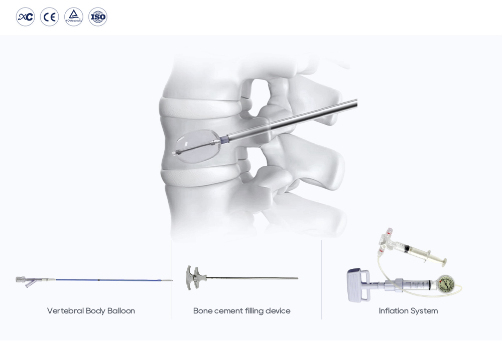 Sistema de cifoplastia esterilizada con bal&oacute;n para el cuerpo vertebral y dispositivo de cemento &oacute;seo para cirug&iacute;a de columna