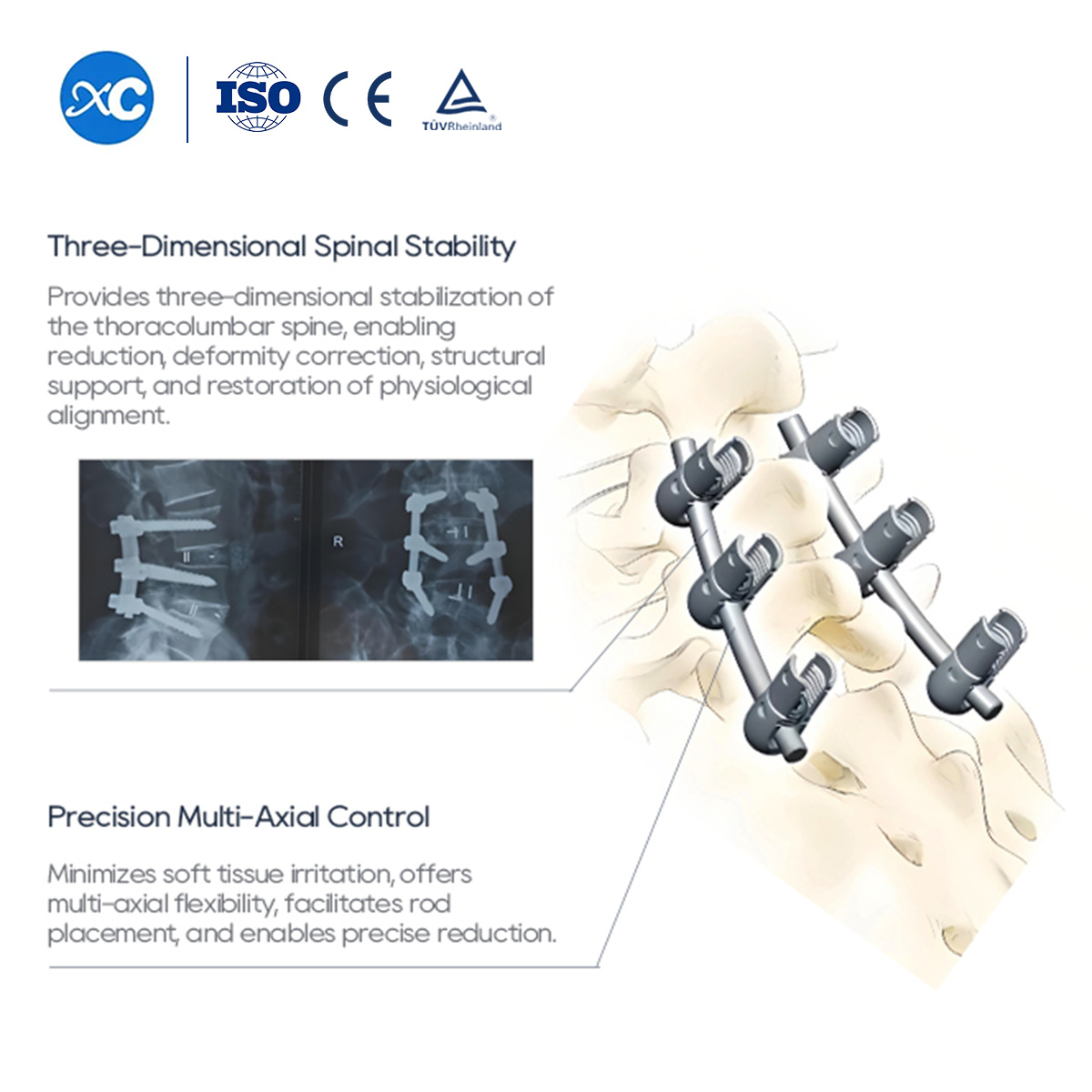Sistema de tornillos pediculares espinales de 6,0 mm