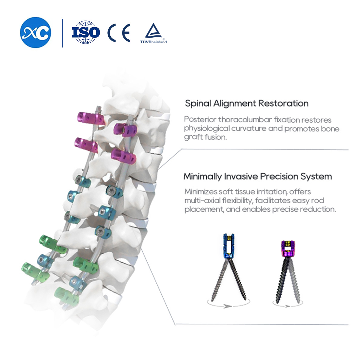 Sistema de tornillos pediculares espinales de 5,5 mm