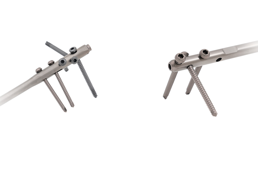 Fabricaci&oacute;n de clavos intramedulares de aleaci&oacute;n de titanio TC20