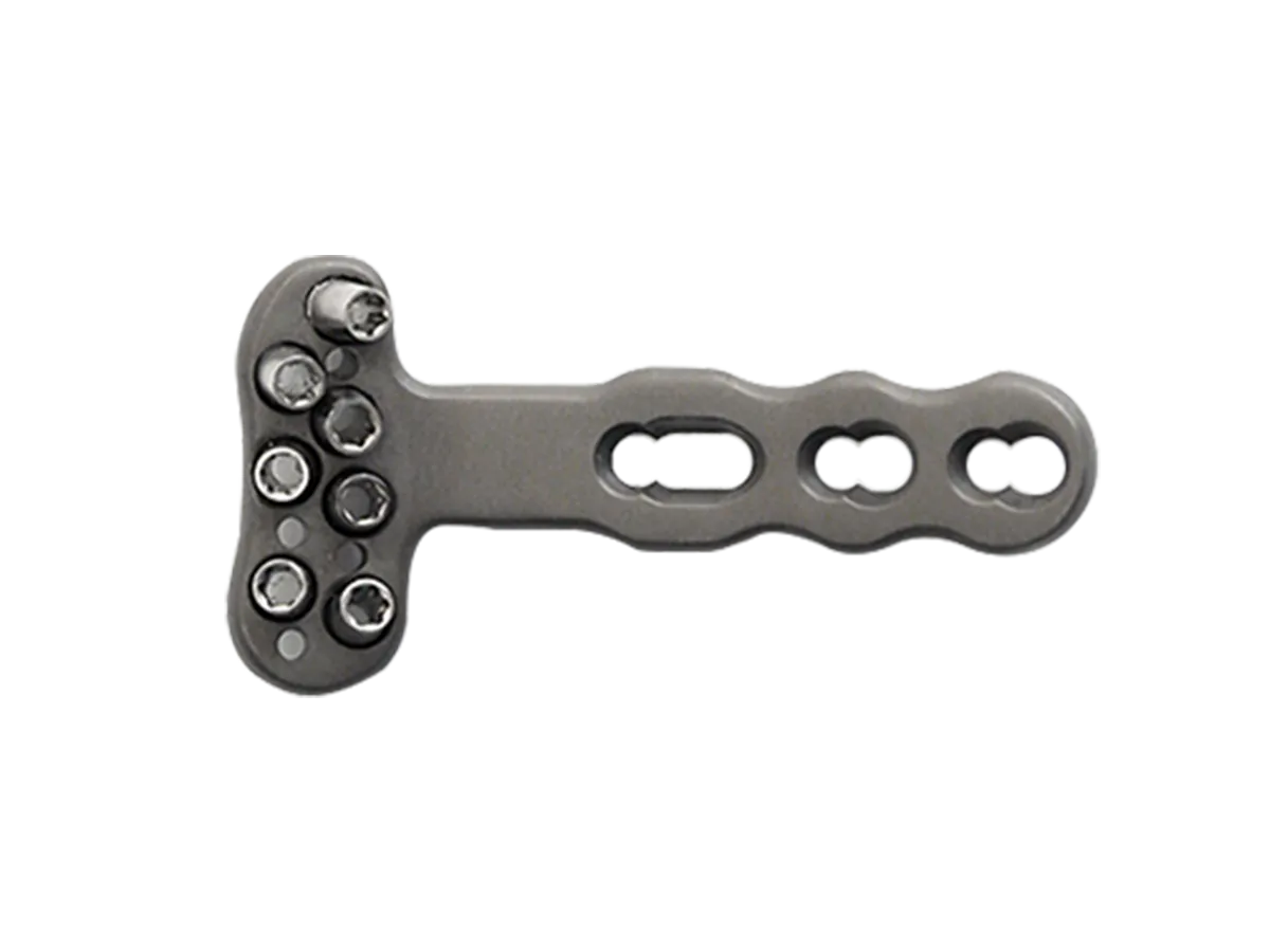 Distal Radius Locking Plate DVR