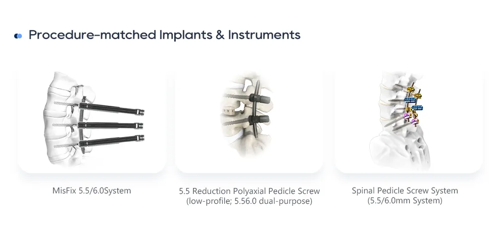Implantes y sistemas de instrumentos de columna lumbar adaptados al procedimiento