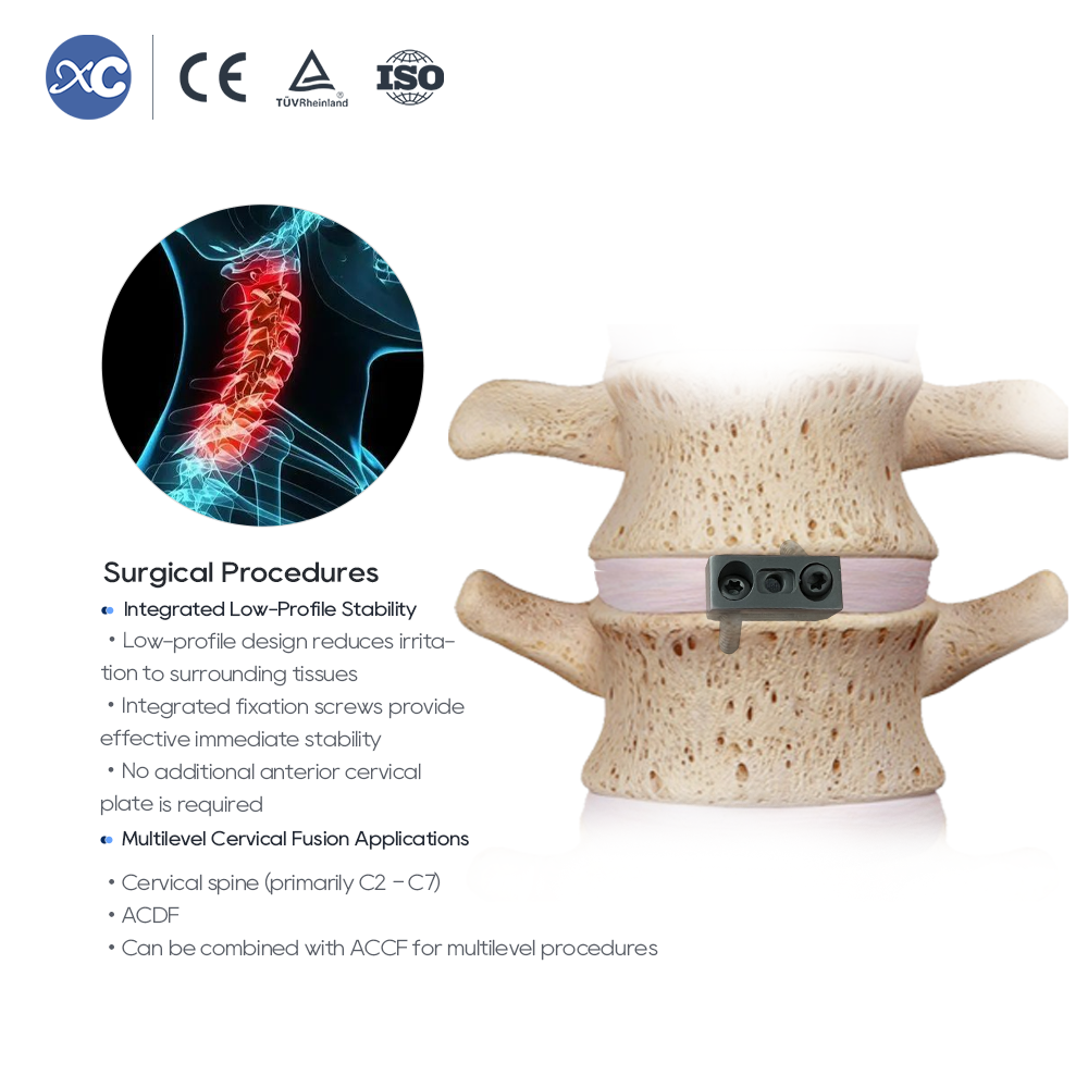 Jaula cervical de perfil cero con 2 tornillos de bloqueo Juego de instrumentos universales