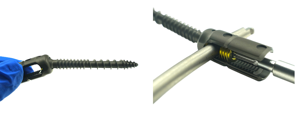 Tornillos pediculares poliaxiales mecanizados por CNC de alta precisi&oacute;n