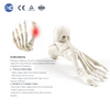 Juego de instrumentos para osteotomía MIS Hallux Valgus