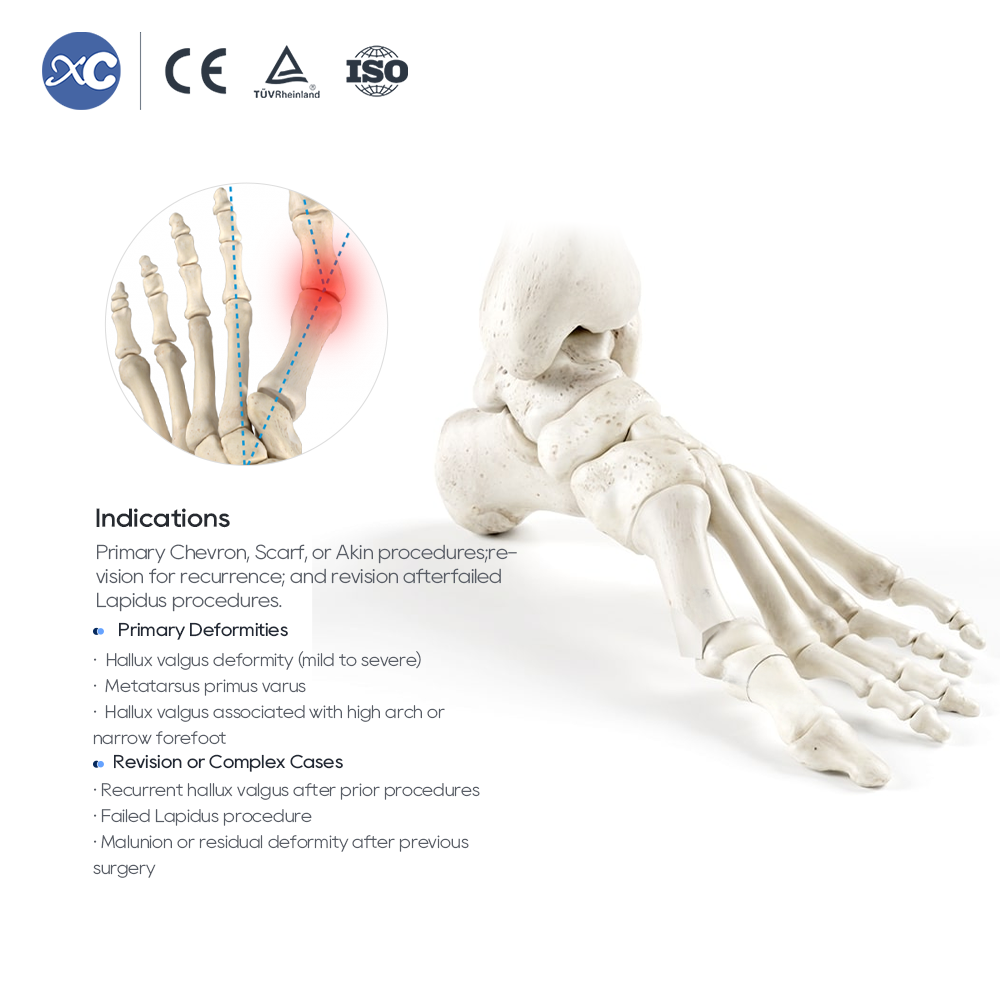 Juego de instrumentos para osteotomía MIS Hallux Valgus