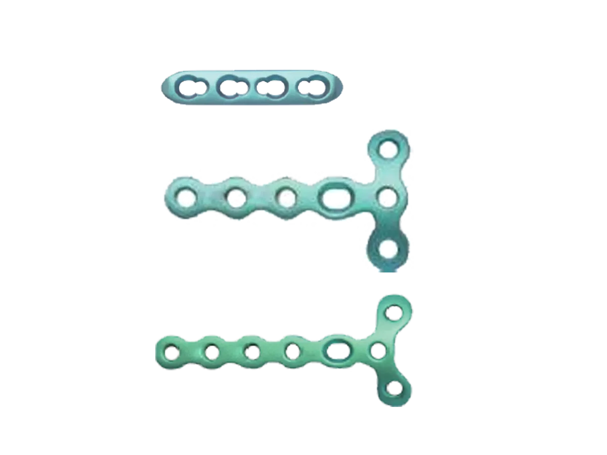 1.5 mm titanium mini locking plate configurations