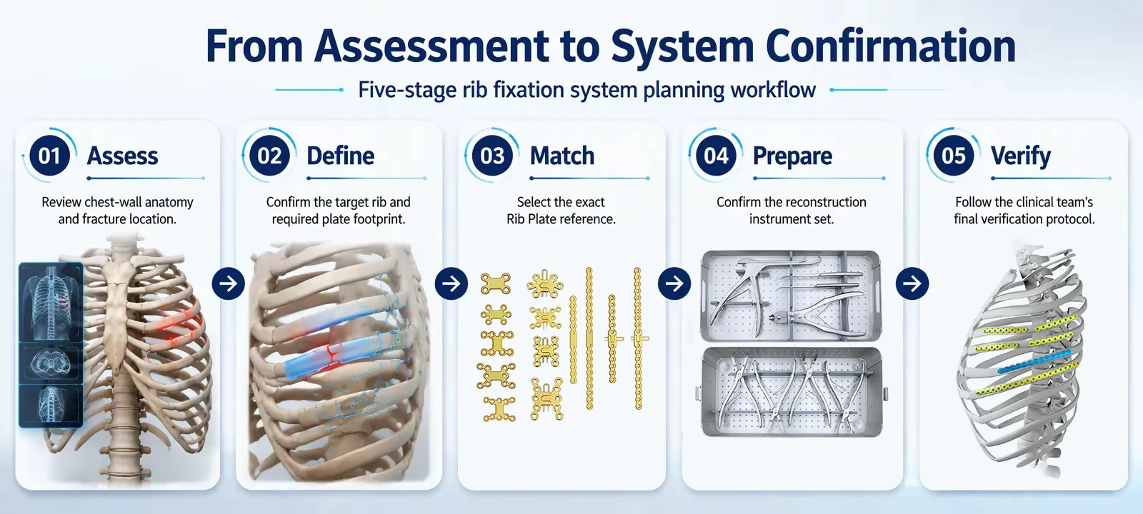 Five-stage rib fixation system planning workflow