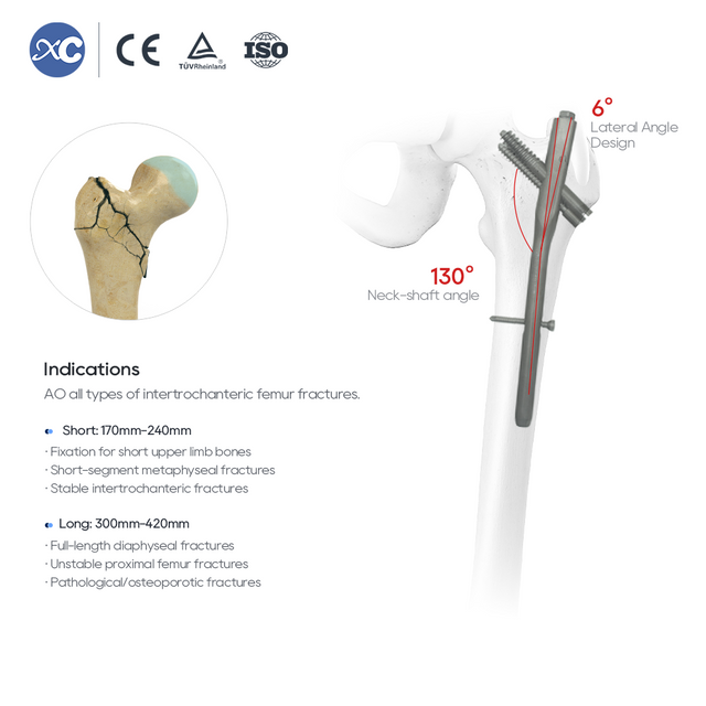 Sistema de clavo intramedular Intertan: fijación de fractura femoral proximal